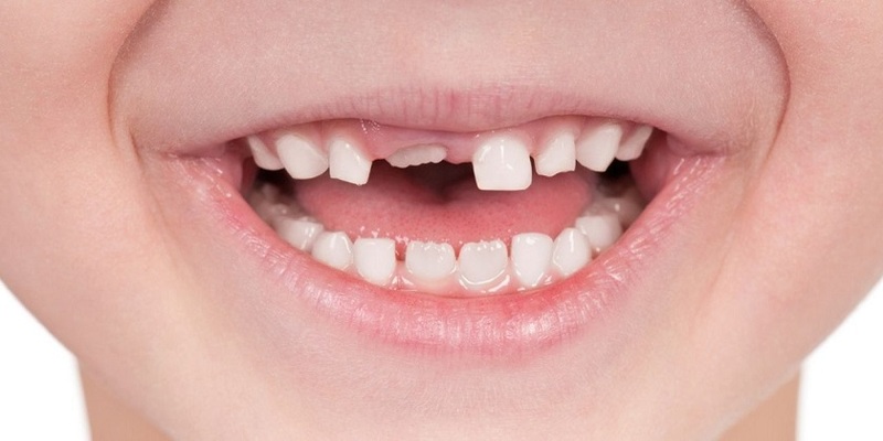 Ý nghĩa đằng sau thắc mắc nằm mơ rụng răng đánh con gì?